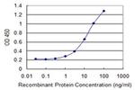 RDH12 Antibody in ELISA (ELISA)