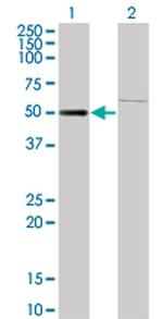 ZNF92 Antibody in Western Blot (WB)