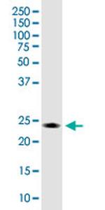 ARCH Antibody in Western Blot (WB)