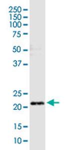 ARCH Antibody in Western Blot (WB)