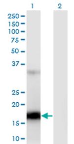 ZCCHC13 Monoclonal Antibody (4G11)