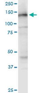 NOMO3 Monoclonal Antibody (5A7)