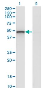 RCAN2 Monoclonal Antibody (1A9)