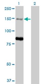 MTMR3 Antibody in Western Blot (WB)