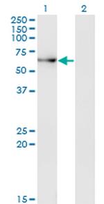 ACD Monoclonal Antibody (1C11-1A7)