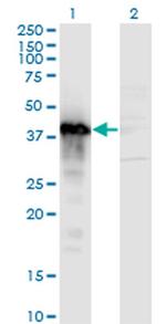 TCEA3 Antibody in Western Blot (WB)