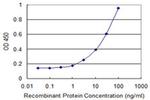 PPP2R3B Antibody in ELISA (ELISA)