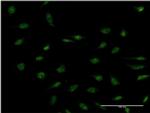 PPP2R3B Monoclonal Antibody (2E12)