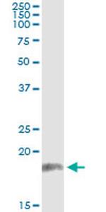 PPP2R3B Antibody in Immunoprecipitation (IP)