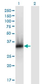 ZNF511 Antibody in Western Blot (WB)