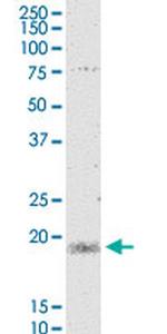 MYL5 Antibody in Western Blot (WB)