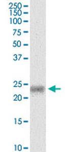 MYL5 Monoclonal Antibody (3D12)