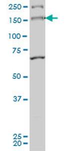 MYO3A Monoclonal Antibody (8D12)