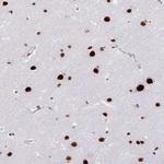 ADAR1 Antibody in Immunohistochemistry (Paraffin) (IHC (P))