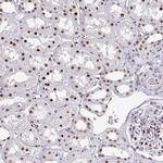 ADAR1 Antibody in Immunohistochemistry (Paraffin) (IHC (P))