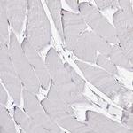 ADAR1 Antibody in Immunohistochemistry (Paraffin) (IHC (P))