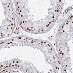 ADAR1 Antibody in Immunohistochemistry (Paraffin) (IHC (P))