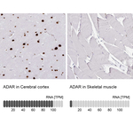 ADAR1 Antibody in Immunohistochemistry (Paraffin) (IHC (P))