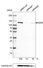 ADAR1 Antibody in Western Blot (WB)