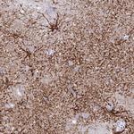 Aquaporin 4 Antibody in Immunohistochemistry (IHC)