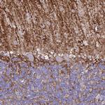 Aquaporin 4 Antibody in Immunohistochemistry (IHC)