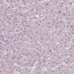 RNASE7 Antibody in Immunohistochemistry (Paraffin) (IHC (P))