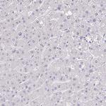 RNASE7 Antibody in Immunohistochemistry (Paraffin) (IHC (P))