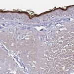 RNASE7 Antibody in Immunohistochemistry (Paraffin) (IHC (P))