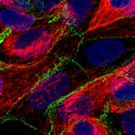 VANGL1 Antibody in Immunocytochemistry (ICC/IF)