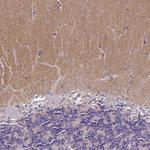 TSPAN7 Antibody in Immunohistochemistry (Paraffin) (IHC (P))
