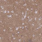 TSPAN7 Antibody in Immunohistochemistry (Paraffin) (IHC (P))