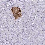 TSPAN7 Antibody in Immunohistochemistry (Paraffin) (IHC (P))