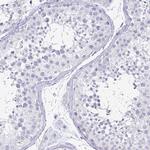 TSPAN7 Antibody in Immunohistochemistry (Paraffin) (IHC (P))
