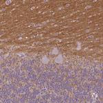 TSPAN7 Antibody in Immunohistochemistry (Paraffin) (IHC (P))