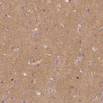 TSPAN7 Antibody in Immunohistochemistry (Paraffin) (IHC (P))