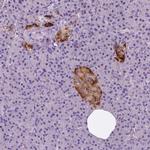 TSPAN7 Antibody in Immunohistochemistry (Paraffin) (IHC (P))