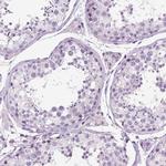 TSPAN7 Antibody in Immunohistochemistry (Paraffin) (IHC (P))