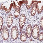 ACSL5 Antibody in Immunohistochemistry (Paraffin) (IHC (P))