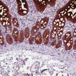 ACSL5 Antibody in Immunohistochemistry (Paraffin) (IHC (P))