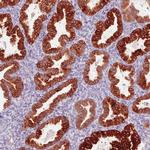 ACSL5 Antibody in Immunohistochemistry (Paraffin) (IHC (P))