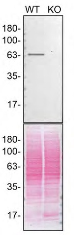 ACSL5 Antibody in Western Blot (WB)
