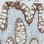 Carbonic Anhydrase XII Antibody in Immunohistochemistry (Paraffin) (IHC (P))