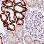 Carbonic Anhydrase XII Monoclonal Antibody (CL0280)