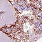 Carbonic Anhydrase XII Antibody in Immunohistochemistry (Paraffin) (IHC (P))