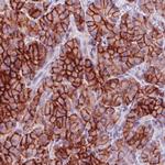 Carbonic Anhydrase XII Antibody in Immunohistochemistry (Paraffin) (IHC (P))