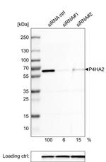 P4HA2 Antibody in Western Blot (WB)