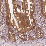 NAPRT1 Antibody in Immunohistochemistry (Paraffin) (IHC (P))