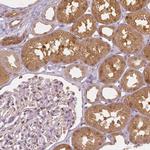 NAPRT1 Antibody in Immunohistochemistry (Paraffin) (IHC (P))