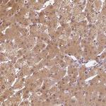 NAPRT1 Antibody in Immunohistochemistry (Paraffin) (IHC (P))