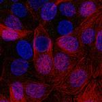 PLA2R1 Monoclonal Antibody (CL0474)